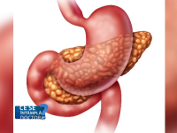 pancreas csid