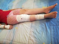 Daune de 17.000 €, după ce o fetiță din Mediaș a fost mușcată de un câine comunitar. De spaimă, mama ei a pierdut sarcina