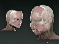 reconstructie faciala