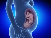 Premiera pentru Romania. 7 specialisti au operat cu succes, pe coloana vertebrala, un bebelus aflat inca in uterul mamei