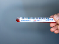 Cel mai eficient test pentru depistarea COVID-19 a fost aprobat în SUA. Cum funcționează