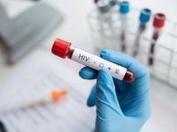 Lupta împotriva HIV, afectată sever de pandemia de COVID-19