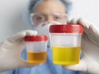 sumar de urină vs urocultura