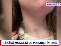 Incident revoltător într-un vagon de tren. O tânără a avut parte de o călătorie de coșmar, după ce a fost mușcată de ploșnițe