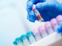 Un test de sânge revoluționar promite depistarea a peste 50 de cancere. Cât de exacte sunt rezultatele