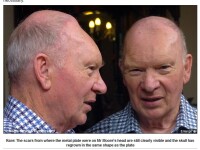 I-a crescut osul la loc, dupa ce si-a pierdut o parte din craniu