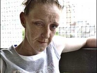 I-a smuls ochiul din orbita, drept pedeapsa pentru ca l-a parasit!