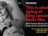 Cea mai socanta campanie anti-fumat. Bolnavi de cancer pe patul de moarte, pe pachetele de tigari