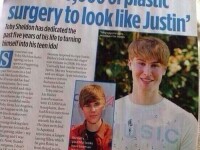 Un barbat de 33 de ani a dat 100.000 de dolari pe operatii pentru a arata ca Justin Bieber