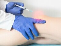 (P) Infiltrațiile intraarticulare cu corticosteroizi: beneficii și recomandări