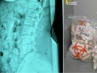 O româncă a fost arestată pe un aeroport din Italia, după ce a fost prinsă cu aproape 1,4 kg de droguri în stomac
