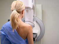 Depistarea precoce a cancerului de sân poate salva vieți. „Pot să apară cancere și la 22 de ani”