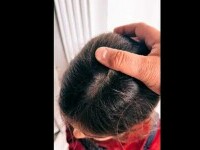 O fetiță de 6 ani a fost rănită în toaleta Palatului Copiilor din Arad. I-a căzut în cap o bucată de faianță