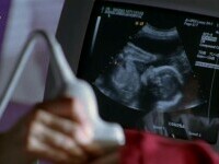 Medicii din Arad propun implanturi contraceptive pentru adolescente, în lupta cu sarcinile timpurii