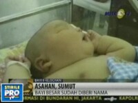 Record in Indonezia! O femeie a nascut un bebelus gigant, de 8,7 kg!