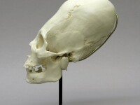 craniu alungit, Peru