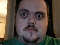 Barbatul care atrage toate privirile pe strada. Ce se intampla cand deschide ochii. VIDEO