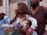 fetita noroi in Siria