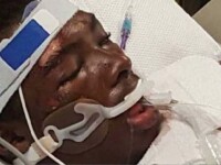 Un tanar a sunat la 911 pentru ajutor, dar a fost batut de politisti si a murit 3 zile mai tarziu. Cum a fost posibil