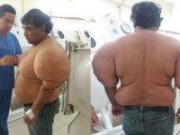 Corpul i s-a deformat și are dureri înfiorătoare. Ce s-a întâmplat cu bărbatul