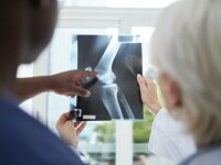 O femeie din Coreea de Sud cu dureri la genunchi a descoperit la radiografie că avea articulațiile pline de fire de aur