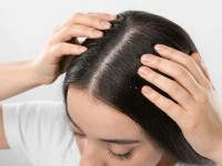 (P) Mătreață persistentă? Alege șamponul antimătreață potrivit!