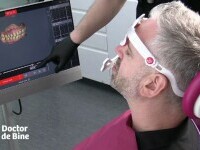 Cum afectează pierderea dinților forma feței și aspectul buzelor. Implanturile dentare moderne pot reda tinerețea