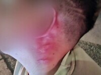 copil strâns de gât