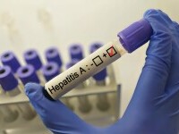 Șapte focare de hepatită virală acută de tip A, depistate în șase localități din județul Dolj. Recomandările medicilor