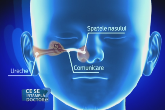 intraductal papilloma hyperplasia semne de condilom la bărbați