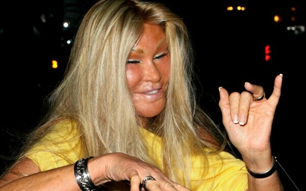 Jocelyn Wildenstein