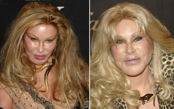 Jocelyn Wildenstein