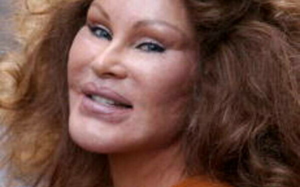 Jocelyn Wildenstein