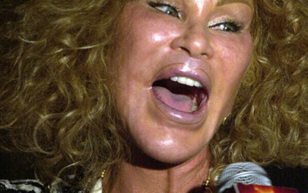 Jocelyn Wildenstein