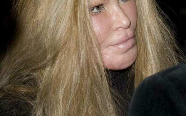 Jocelyn Wildenstein