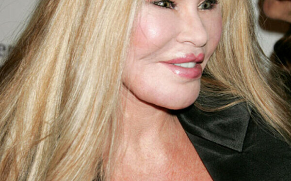 Jocelyn Wildenstein