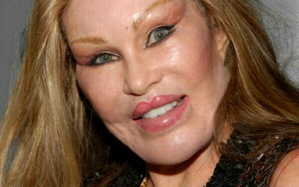 Jocelyn Wildenstein