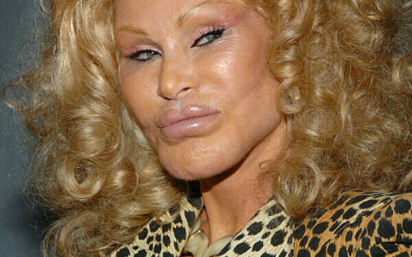 Jocelyn Wildenstein