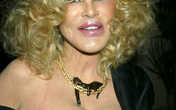 Jocelyn Wildenstein