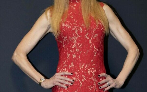 Nicole Kidman