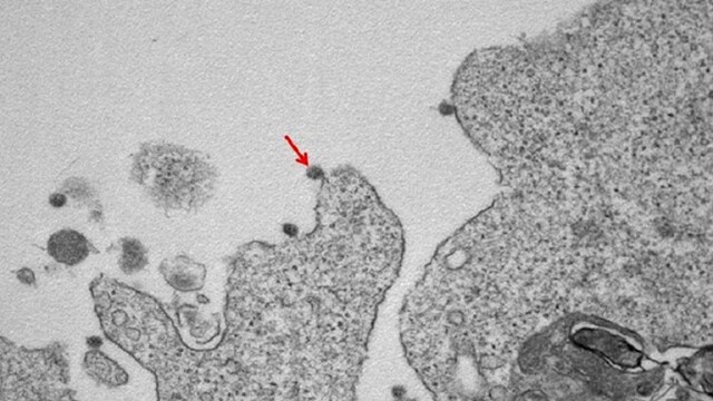 Cum arată coronavirusul care produce COVID-19. Imagini în premieră, de la cercetători - Imaginea 2