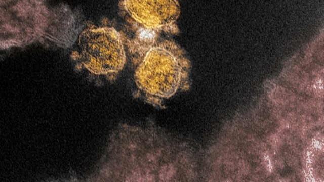 Cum arată coronavirusul care produce COVID-19. Imagini în premieră, de la cercetători - Imaginea 3