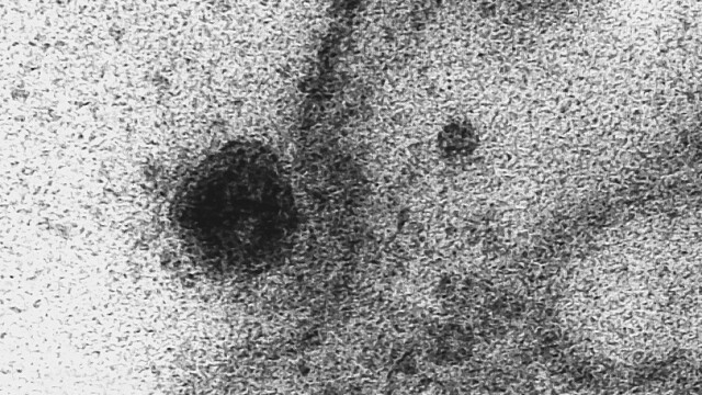 Cum arată coronavirusul care produce COVID-19. Imagini în premieră, de la cercetători - Imaginea 5