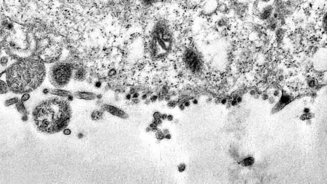 Cum arată coronavirusul care produce COVID-19. Imagini în premieră, de la cercetători - Imaginea 12