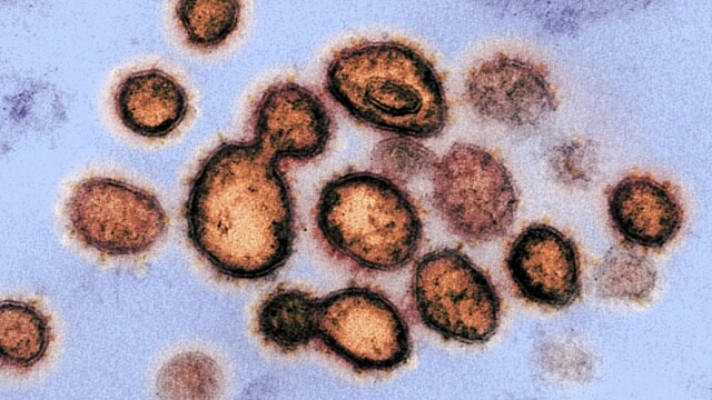 Cum arată coronavirusul care produce COVID-19. Imagini în premieră, de la cercetători - Imaginea 13