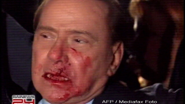 Silvio Berlusconi, plin de sange! Are nasul spart si doi dinti rupti! - Imaginea 1