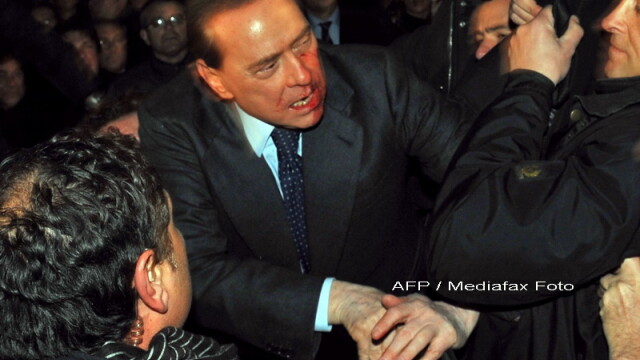 Silvio Berlusconi, plin de sange! Are nasul spart si doi dinti rupti! - Imaginea 3