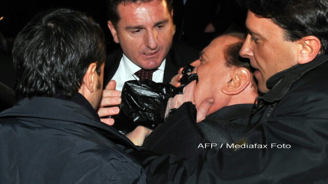 Silvio Berlusconi, plin de sange! Are nasul spart si doi dinti rupti! - Imaginea 4