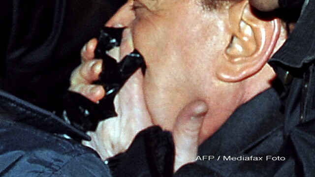Silvio Berlusconi, plin de sange! Are nasul spart si doi dinti rupti! - Imaginea 5