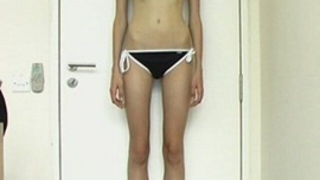 Modele macinate de anorexie. Sacrificiul pentru o viata pe catwalk FOTO - Imaginea 6